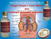 Cap Shen Menyembuhkan Gagal Ginjal