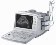 Portable Ultrasound Scanner ( ZQ-6600plus)