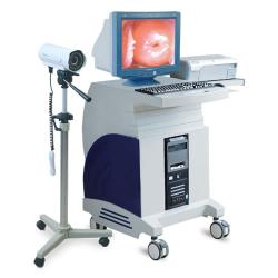 Electronic Colposcope