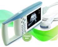 Palmtop ultrasound ( USG model Palmtop)