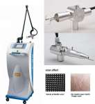 CO2 Fractional Laser