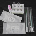 HIV saliva rapid test