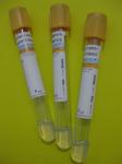 Vacuum Blood Collection Tube