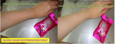 quickly magic whitening soap( KOJIC SOAP)