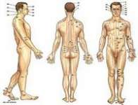 Pelatihan Akupunktur