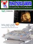 USG 4G Chison ivis 60 Live [ 4 Dimensi]