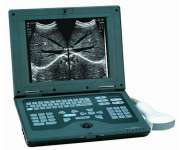 Notebook ultrasound scanner YSB0103