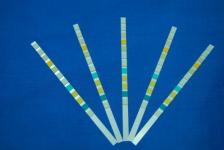 urine test strips(glucose)