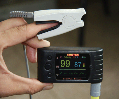 CMS 60C TFT color Pulse oximeter