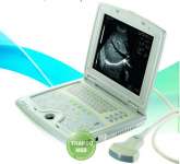 Laptop Ultrasound